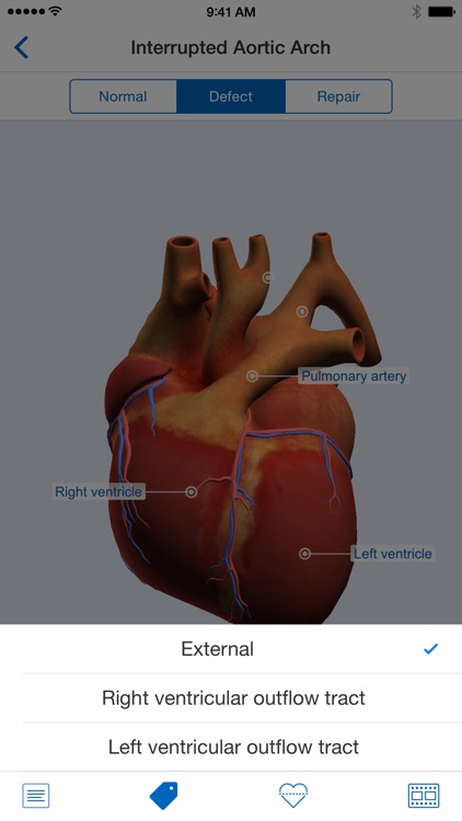 Heartpedia
