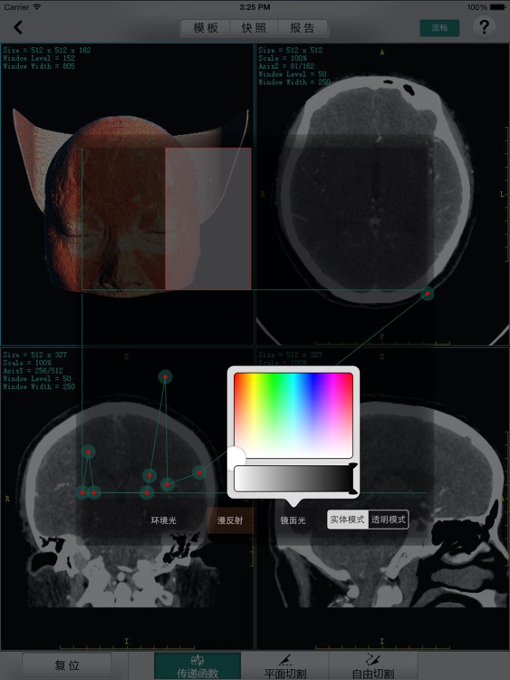 Xavier, 安博医学3D成像 screenshot-4