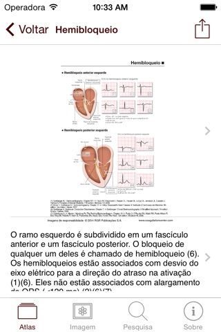 Atlas Fibrilação atrial screenshot 3