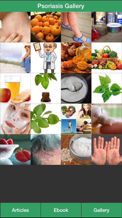 Psoriasis Guide - Learn How to Treat Your Psoriasis Naturally!