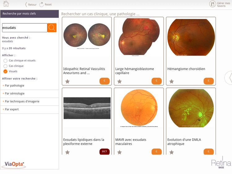 Retina Base
