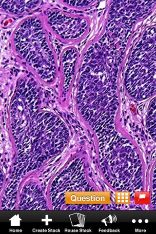Dermatology In-Review Kodachrome Flashcard Series screenshot 4