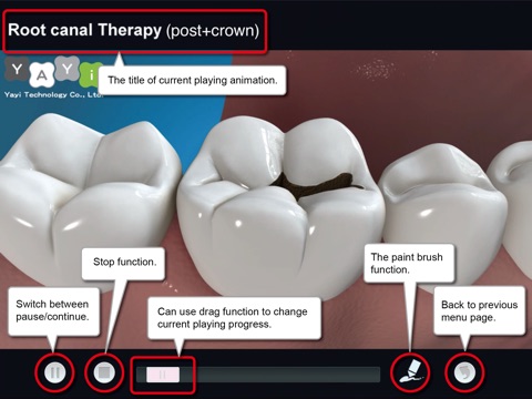 Dental Consult－English Audio Version screenshot 4