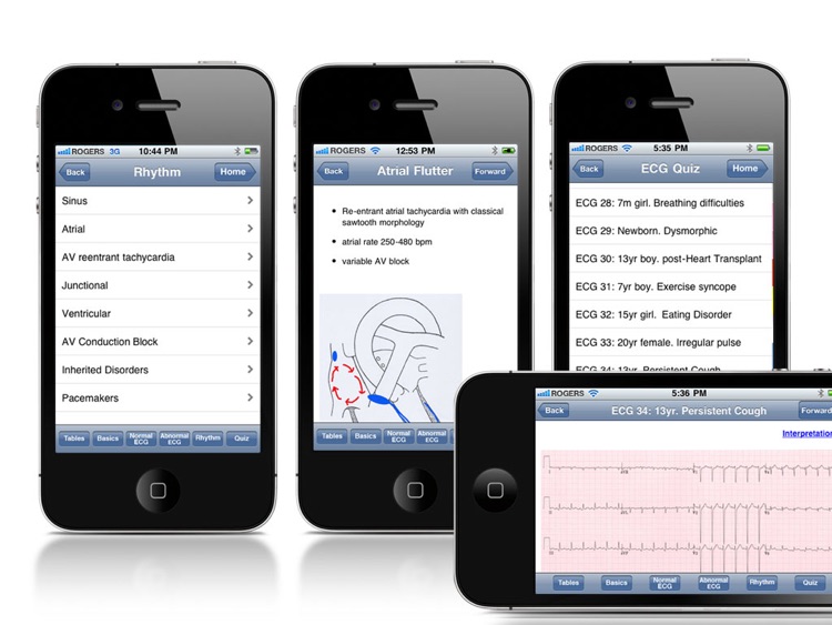 Paedcard ECG screenshot-4