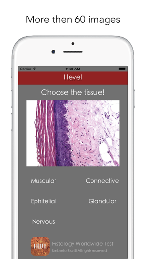 Histology Worldwide Test Lite for iPhone(圖2)-速報App