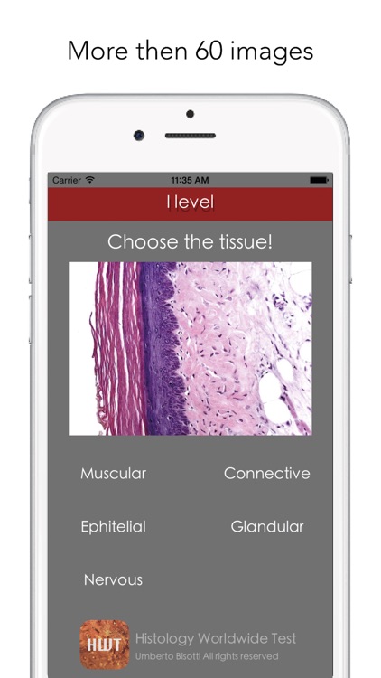 Histology Worldwide Test Lite for iPhone