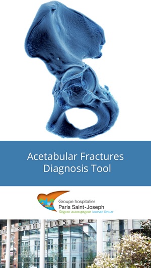 Acetabular Fractures - Hôpital Paris Sai