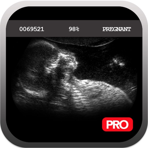 Pregnancy Spoof Prank Free - Pregnant Spoof And Fake Pregnancy Trick icon