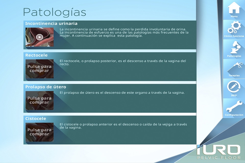 iURO Pelvic Floor screenshot 3