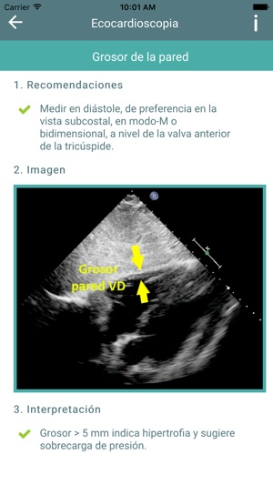 Ecocardioscopia(圖2)-速報App