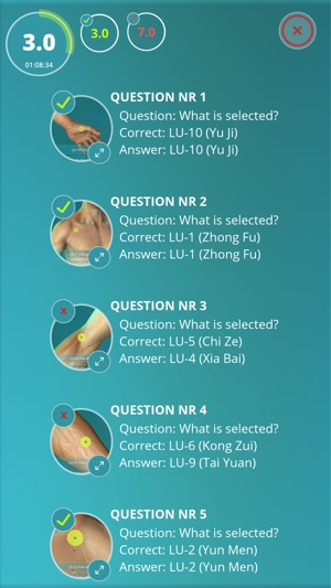 Acupuncture Quiz - Point Locations(圖3)-速報App