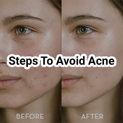 Steps to avoid acne icon