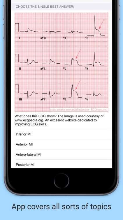 iMCQs in General Medicine screenshot-4
