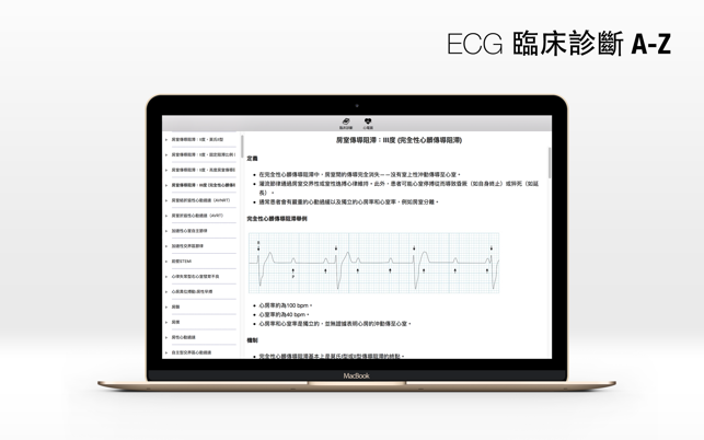 ECG A-Z(圖3)-速報App