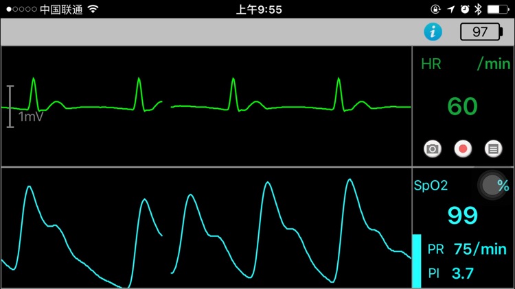 LP vital monitor