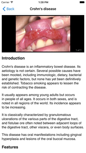 Key to the Diagnosis of Oral Ulceration(圖5)-速報App