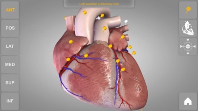 心臓解剖 Heart 3D Atlas o... screenshot1