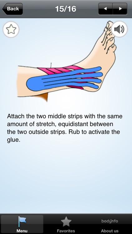 Ankle sprain