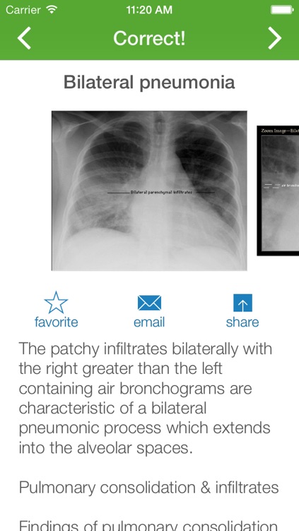 Chest X-Ray Training