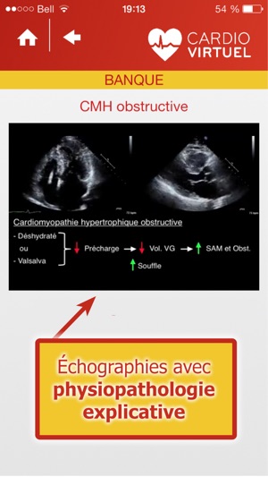 Cardio Virtuel présenté par des médecins spécialistes de l'U(圖4)-速報App