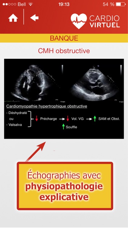 Cardio Virtuel présenté par des médecins spécialistes de l'Université Laval screenshot-3