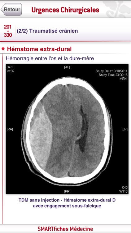 SMARTfiches Urgences Chirurgicales screenshot-3