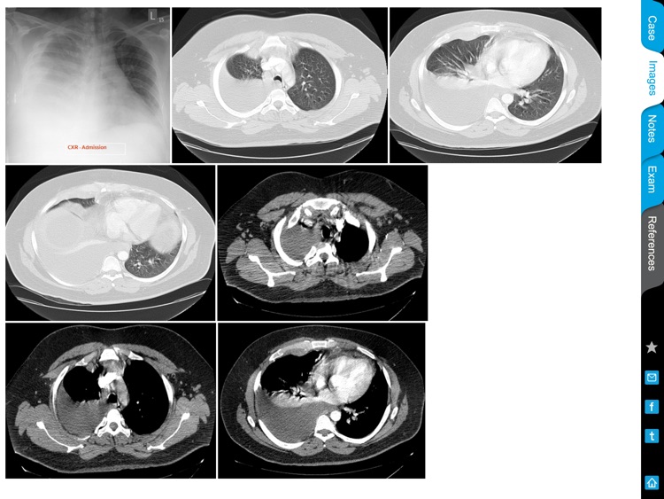 ACCP Radiology Cases screenshot-3
