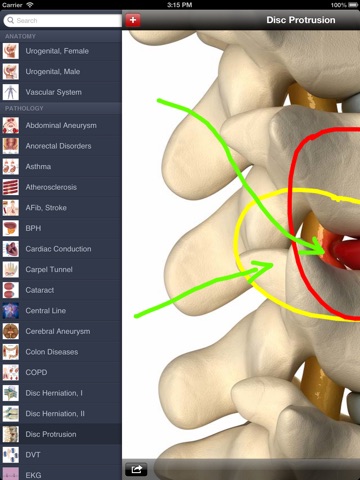 Med Sketch: Anatomy Drawing App for iPad screenshot 2