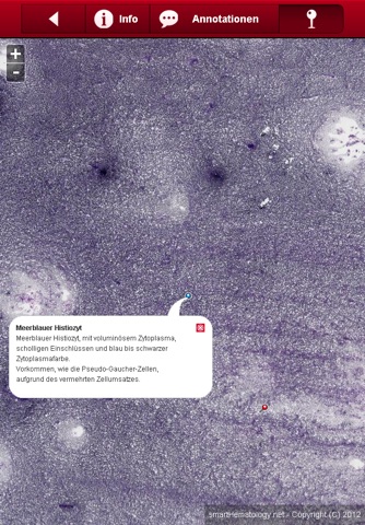 Smart Hematology Lite screenshot 2