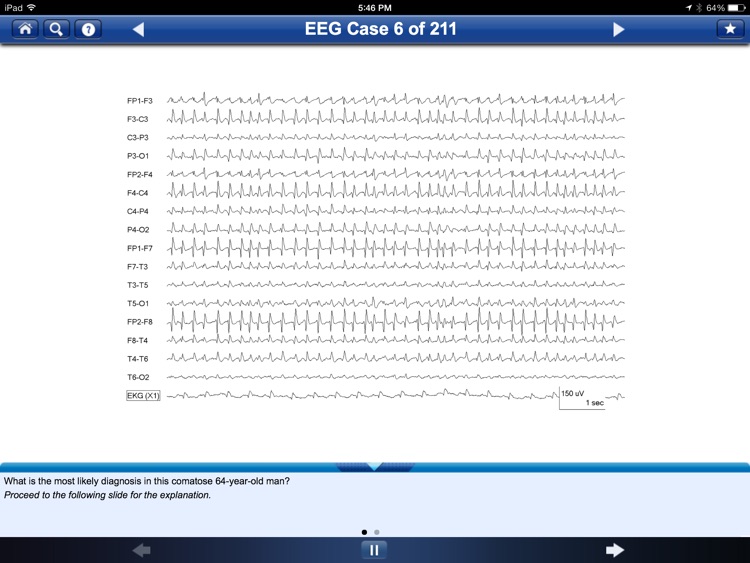 Adult EEG: An Interactive Reading Session