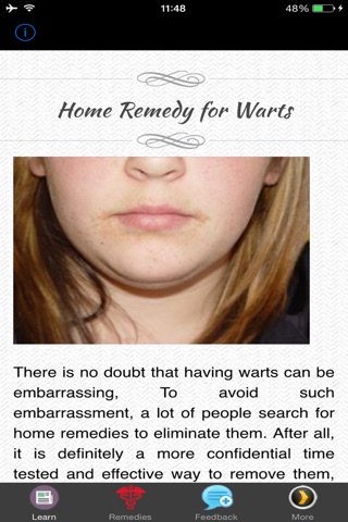 Home Remedies And Tips For Warts screenshot 2