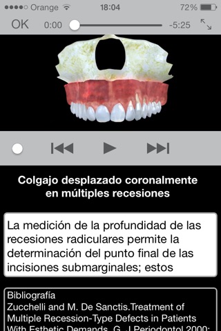Periodontal Advanced Surgery By Mariano Sanz screenshot 3