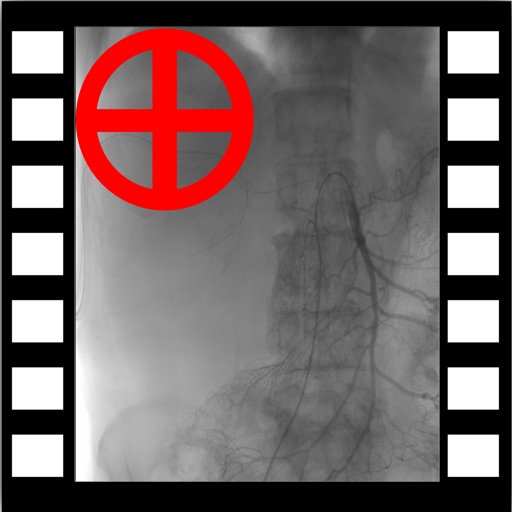 iMedViewer