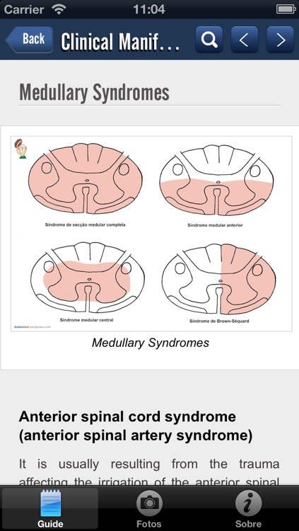Spinal Cord Trauma