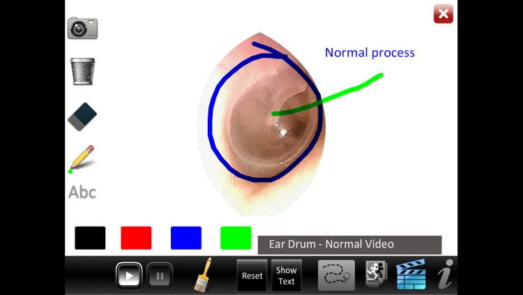 Ear ID screenshot-3