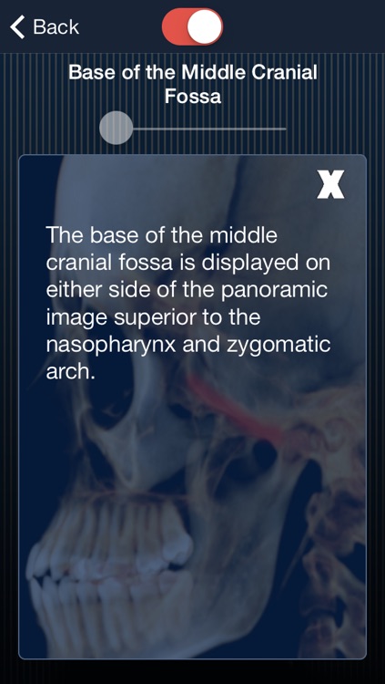 Dental Panoramic Radiology screenshot-4
