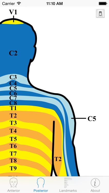 Dermatomes