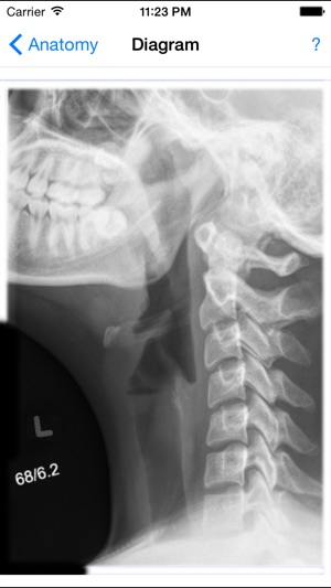 Tracheostomy 2: Pediatric Tracheostomy for Healthcare Studen(圖2)-速報App