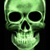 Skull X-Ray