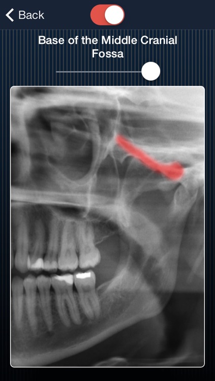 Dental Panoramic Radiology