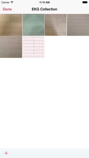 Photo EKG(圖3)-速報App