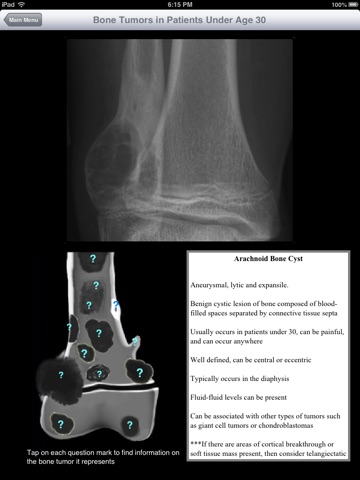 iMSK Bone Tumors screenshot 2