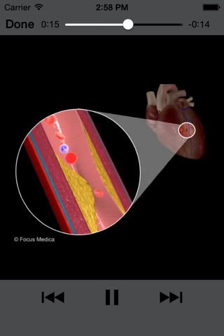 Cardiology Dictionary screenshot 4