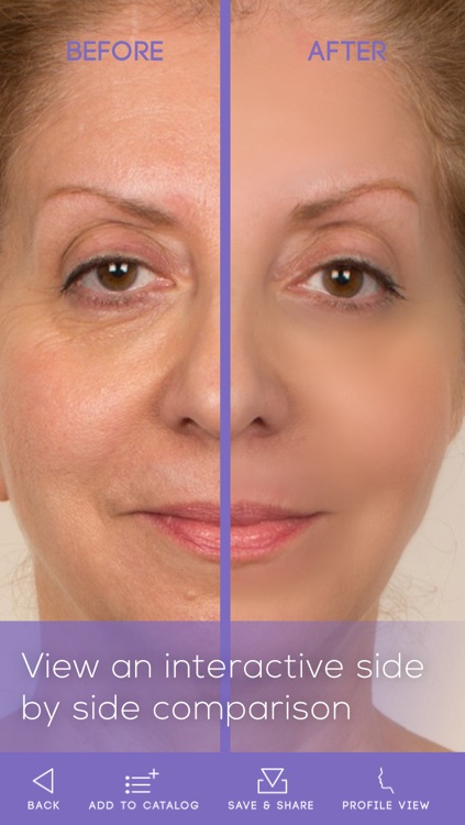 FaceLift: Cosmetic Surgery Simulator + Perfect Skin + Anti-Aging Visualizer screenshot-3