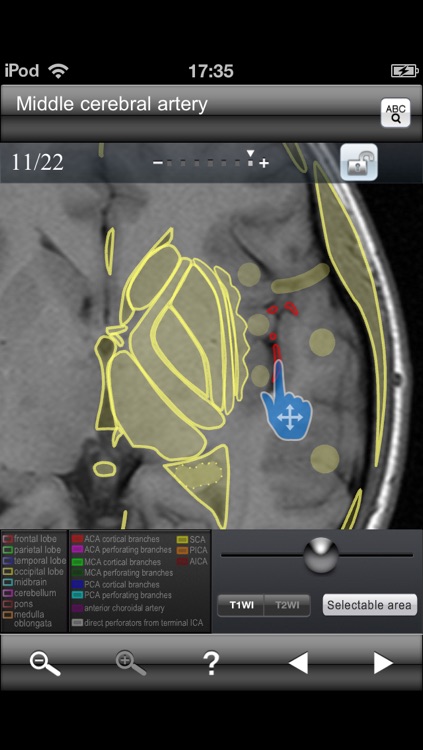 Brain MRI Sectional Walker screenshot-3