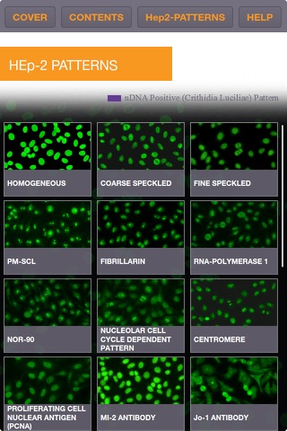 ZEUS IFA Digital ANA HEp-2 Cell Pattern Identification Guide screenshot 3