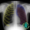 Chest X-ray