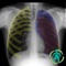 Chest X-ray is one of the most innovative educational resources in the medical field