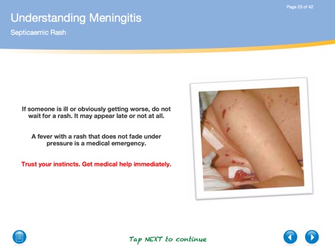 Understanding Meningitis - Free screenshot 4