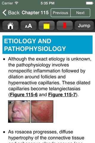 Atlas of Internal Medicine screenshot 3